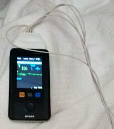 A kórházi éjszaka nem pihenésre, nem alvásra való. Legalább is itt nem gondolták úgy, hogy az éjszaka alvásra való. Kezdem ott, hogy a vérnyomásmérő negyedóránként automatikusan megmérte a vérnyomásomat. Ugyanez a ketyere, amire rá voltam kapcsolva fokozatosan számolta a pulzusomat. Három percenként hangos sípolással jelezte, hogy megmért. A monitoron persze megjelent a pulzus és a vérnyomásérték. A készülék ugyancsak automatikusan, folyamatosan mérte a szaturációt is. Legalább az nem adott hangot. Óránként megjelent egy nővérke, aki lázat mért.